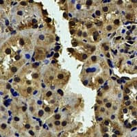 CALCOCO1 / CoCoa Antibody