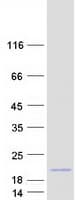 Human SDHAF3 / ACN9 Protein (Recombinant Myc-DDK (Flag))