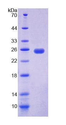 Human UP / UPP1 Protein (Recombinant His-T7)