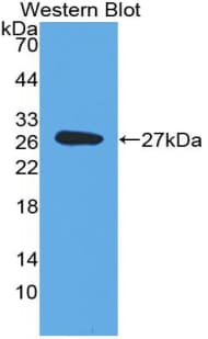 ICAM-1 / CD54 Antibody (aa102-306, APC)