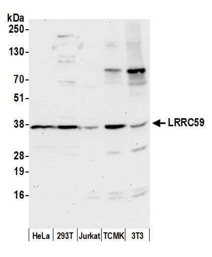 Polyclonal Rabbit anti-Human LRRC59 Antibody (aa200-250, WB)