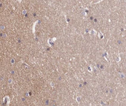 ABL1 / c-ABL Antibody (phospho-Tyr412)