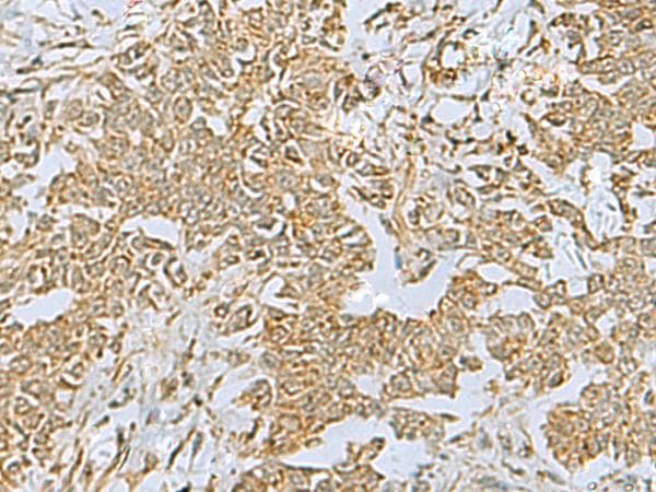 C17orf70 Antibody