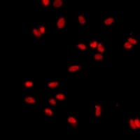 Polyclonal Rabbit anti-Human PMS2 Antibody (IF, WB)