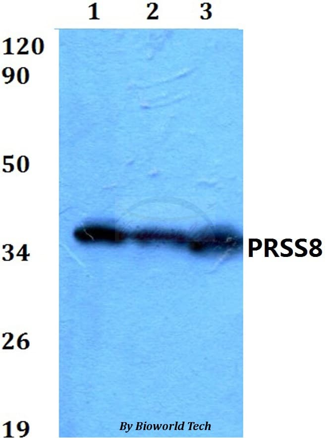 Polyclonal Rabbit anti-Human PRSS8 / Prostasin Antibody (WB)
