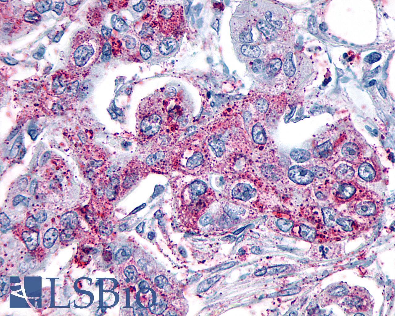 PathPlus™ GRM8 / MGLUR8 Antibody (N-Terminus)