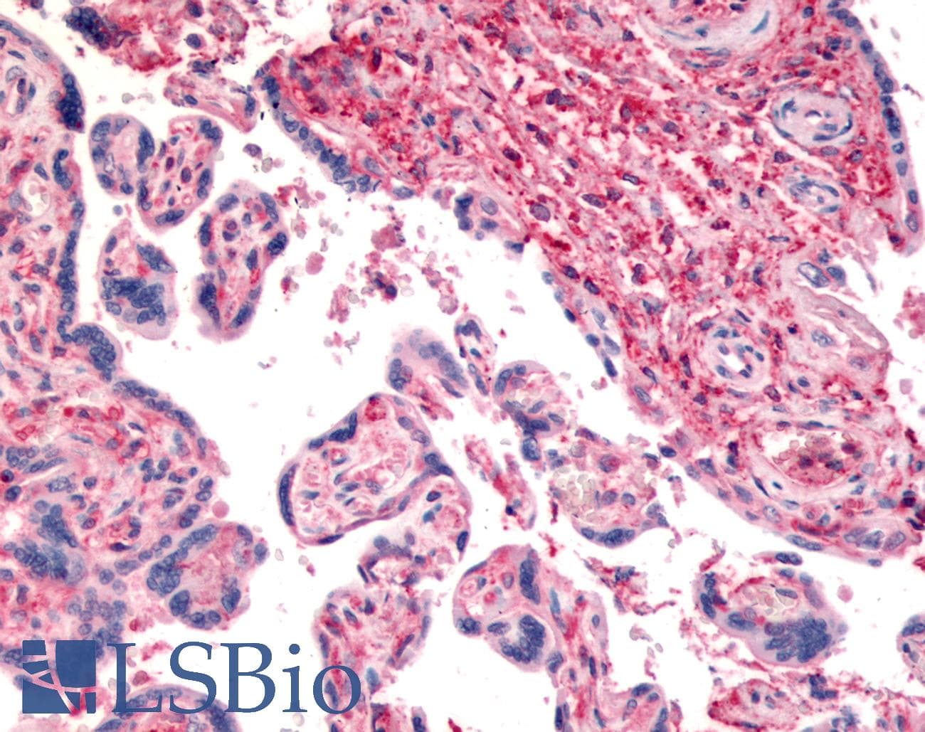IHC-plus™ Polyclonal Rabbit anti-Human DPP4 / CD26 Antibody (Internal, IHC)