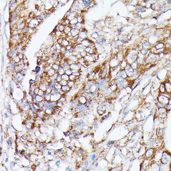 Polyclonal Rabbit anti-Human NBP / NUBP1 Antibody (IHC)