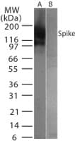 Polyclonal Rabbit anti-Coronavirus SARS-CoV Spike Glycoprotein Antibody (aa553-570, WB)