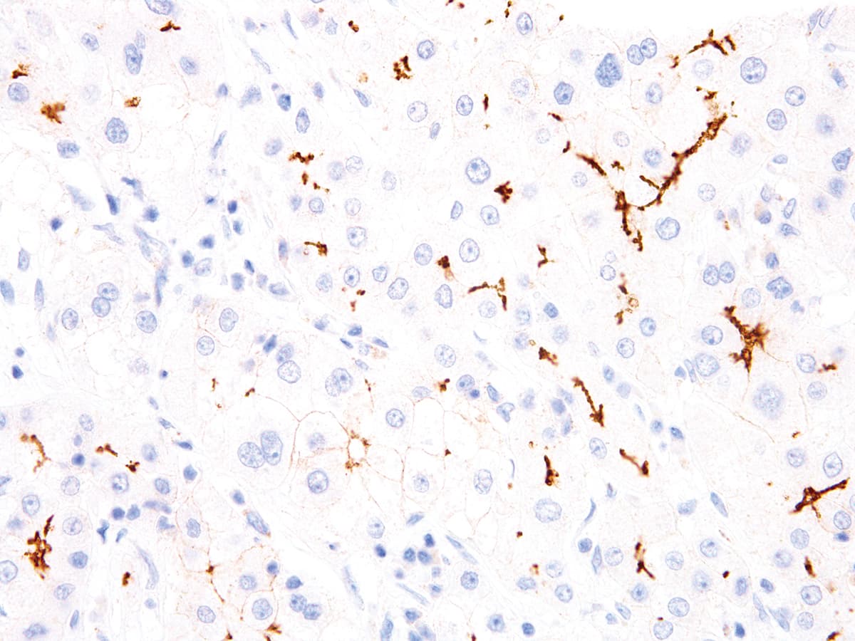 Monoclonal Mouse anti-Human ABCB11 / BSEP Antibody (Ready-to-Use, IHC)