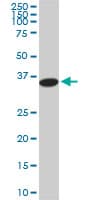 Monoclonal Mouse anti-Human PGGT1B Antibody (clone 5E4, IHC, IF, WB)