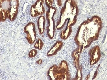 KRT18 / CK18 / Cytokeratin 18 Antibody (clone KRT18/834)