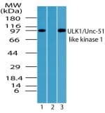 IHC-plus™ ULK1 Antibody