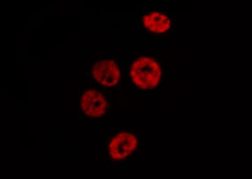 MCM2 Antibody