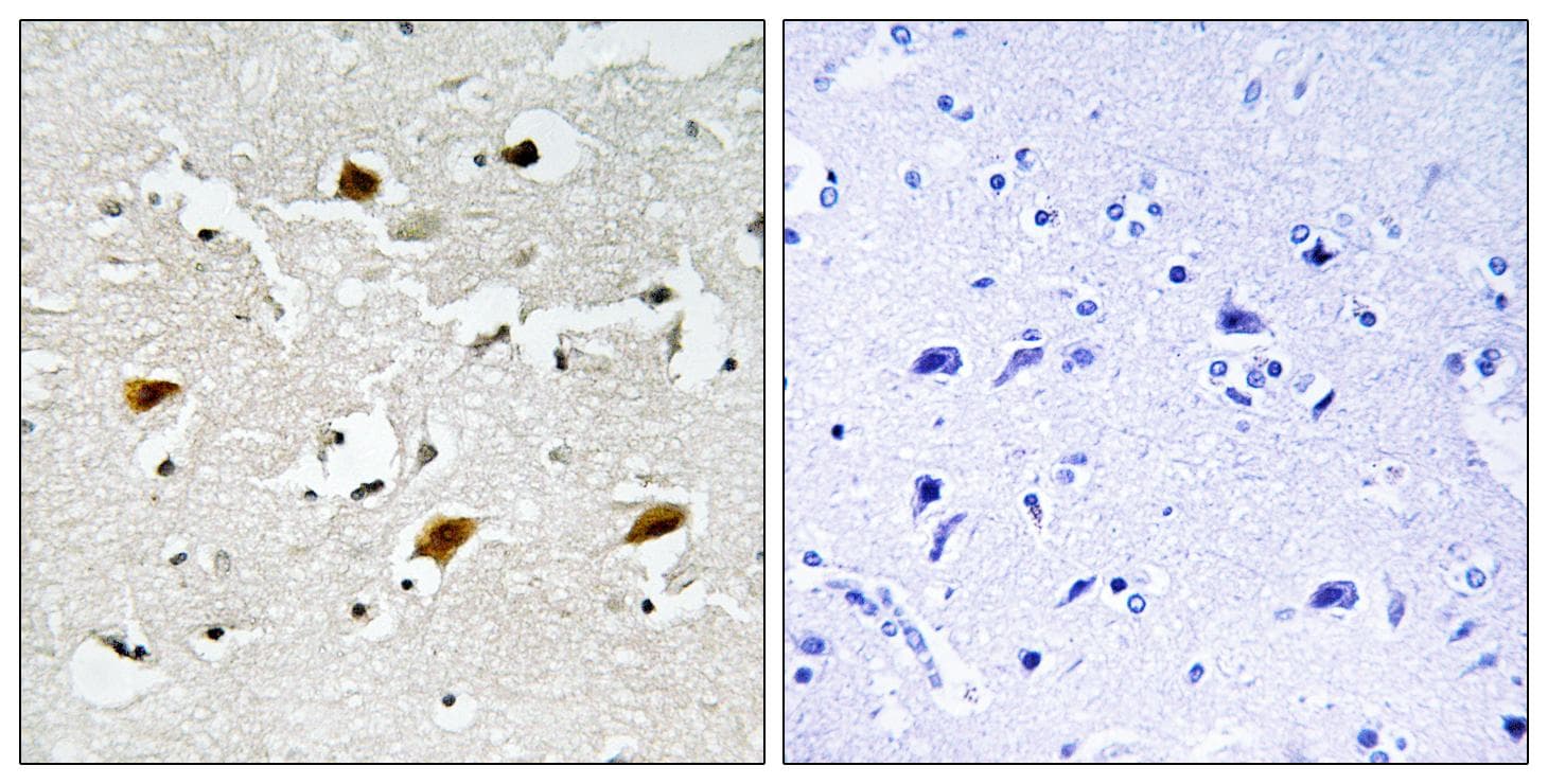 CDKN1B / p27 Kip1 Antibody (phospho-Thr157)