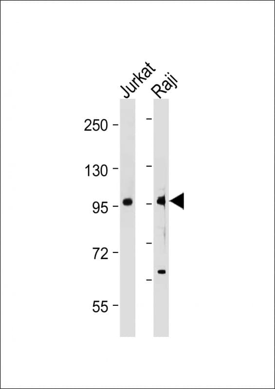 Polyclonal Rabbit anti-Human MAP4K1 / HPK1 Antibody (WB)