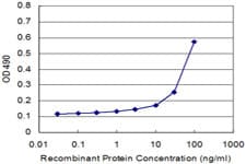 IHC-plus™ Monoclonal Mouse anti-Human CDKN1B / p27 Kip1 Antibody (clone 4B4-E6, IHC, IF, WB)