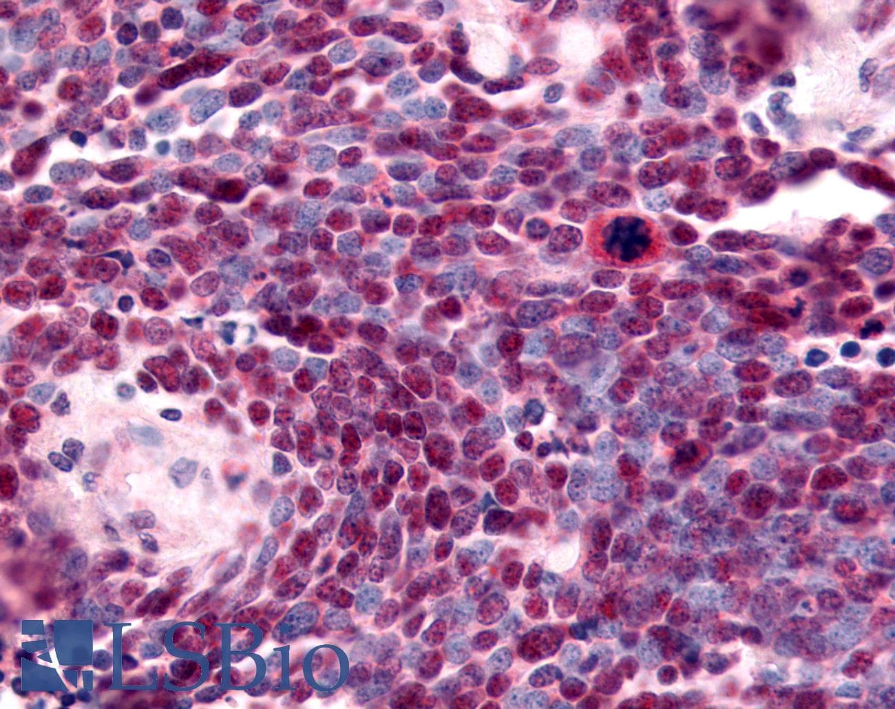 PathPlus™ NR2E1 / TLX Antibody (N-Terminus)