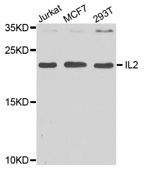 Polyclonal Rabbit anti-Human IL2 Antibody (IHC, WB)
