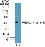 HDAC7 Antibody (aa443-452)
