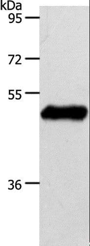 S1PR1 / EDG1 / S1P1 Antibody