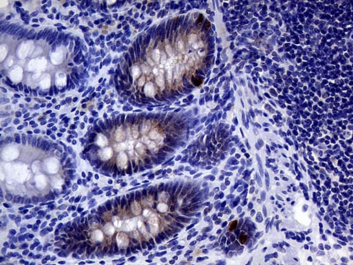 IL24 Antibody (aa52-206, clone OTI4H4)