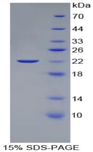 Bovine PTHLH / PTHRP Protein (Recombinant His-S)