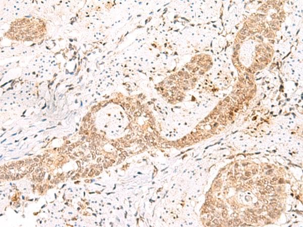 PRKAG2 / AMPK Gamma 2 Antibody