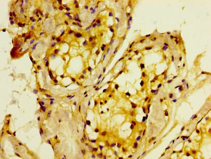 MTMR2 Antibody