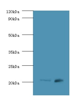 HRAS / H-Ras Antibody (Biotin)