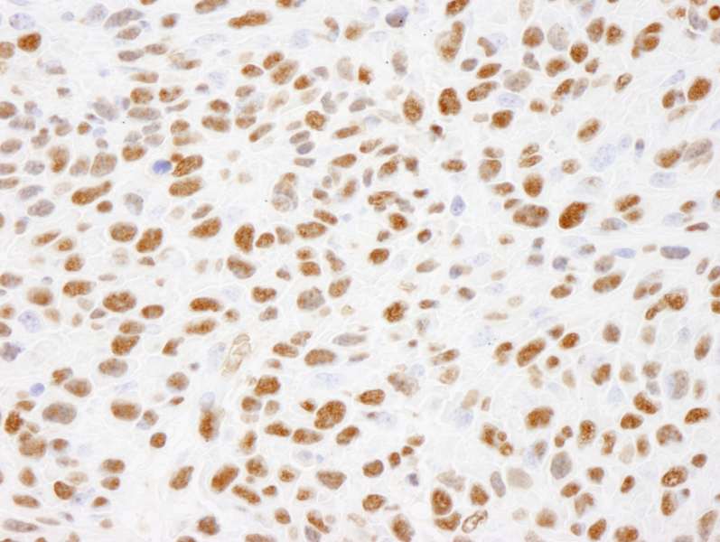 XRCC1 Antibody (phospho-Ser485 / pThr488)