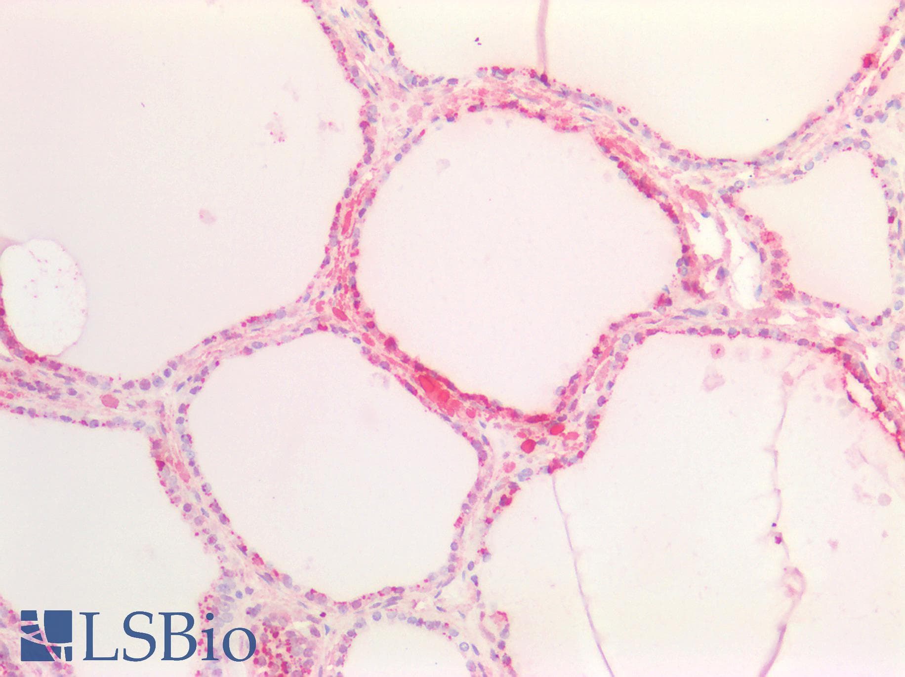 IHC-plus™ SOX9 Antibody (aa5-18)