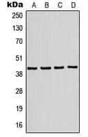 Polyclonal Rabbit anti-Human KCNJ10 / SESAME / KIR4.1 Antibody (Internal, WB)