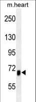 ACVR1B / ALK4 Antibody