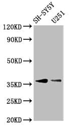 Polyclonal Rabbit anti-Human BARHL1 Antibody (IHC, WB)