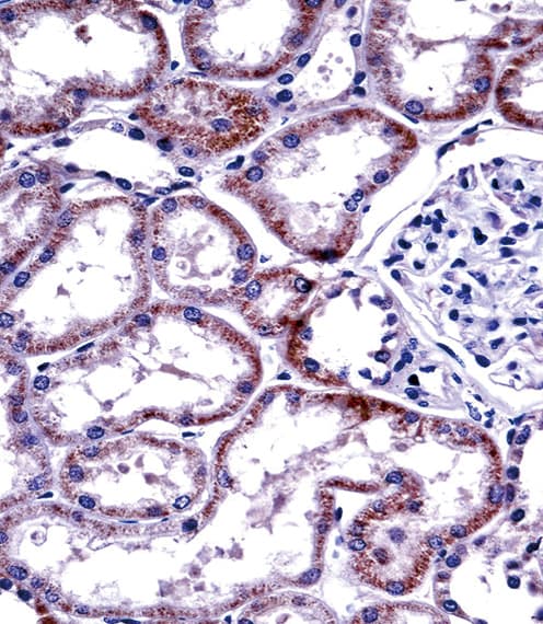 HNF4A / HNF4 Antibody (aa281-312)