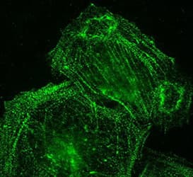 PALLD / Palladin Antibody (clone 1E6, DY488)