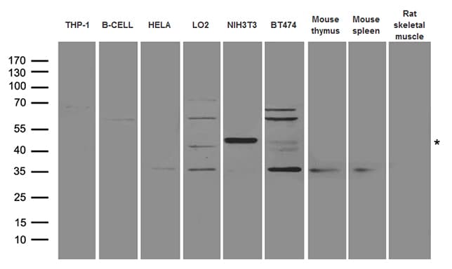 Polyclonal Rabbit anti-Human AML1 / RUNX1 Antibody (WB)