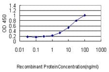 Monoclonal Mouse anti-Human VILIP / VSNL1 Antibody (clone 2F1-E3, WB)