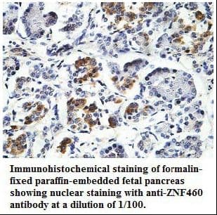 Polyclonal Rabbit anti-Human ZNF460 Antibody (aa207-507, IHC, WB)