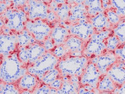 Monoclonal Mouse anti-Porcine A2M / Alpha-2-Macroglobulin Antibody (clone PAM-F101, IHC, WB)