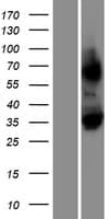 Human LRRC30 Protein (Over-Expression Lysate Myc-DDK (Flag))