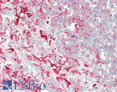 IHC-plus™ Polyclonal Rabbit anti-Human AMPD2 Antibody (IHC, IF)