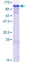 Human GSPT1 Protein (Recombinant GST, N-terminus)