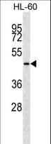 KRT28 / Keratin 28 Antibody (aa432-460)