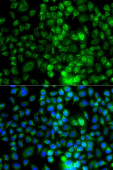EPHA1 / EPH Receptor A1 Antibody