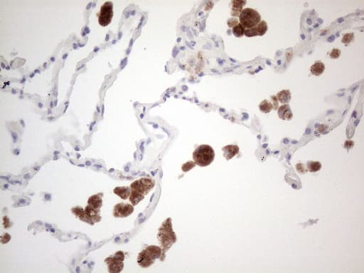 CD40 Antibody (aa21-166, clone UMAB183)