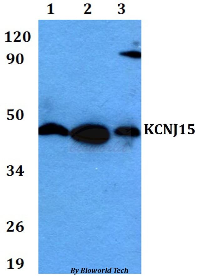 KCNJ15 / KIR4.2 Antibody