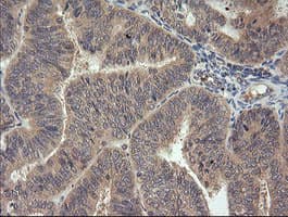 MAP2K3 / MEK3 / MKK3 Antibody (clone OTI5D3, Carrier-free)