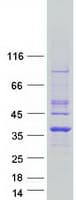 Human PYCR1 Protein (Recombinant Myc-DDK (Flag))